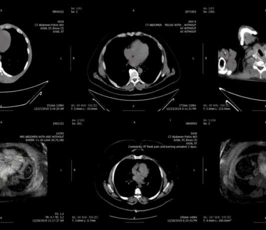 miliard imagini medicale internet