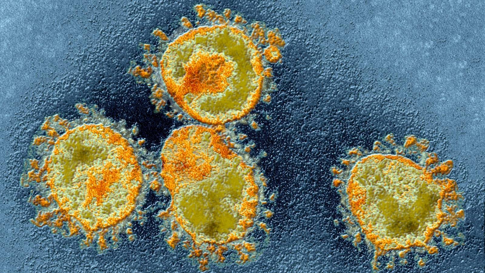 Coronavirus Romania Numarul Nou Cazurilor Noi 13 Noiembrie 2022