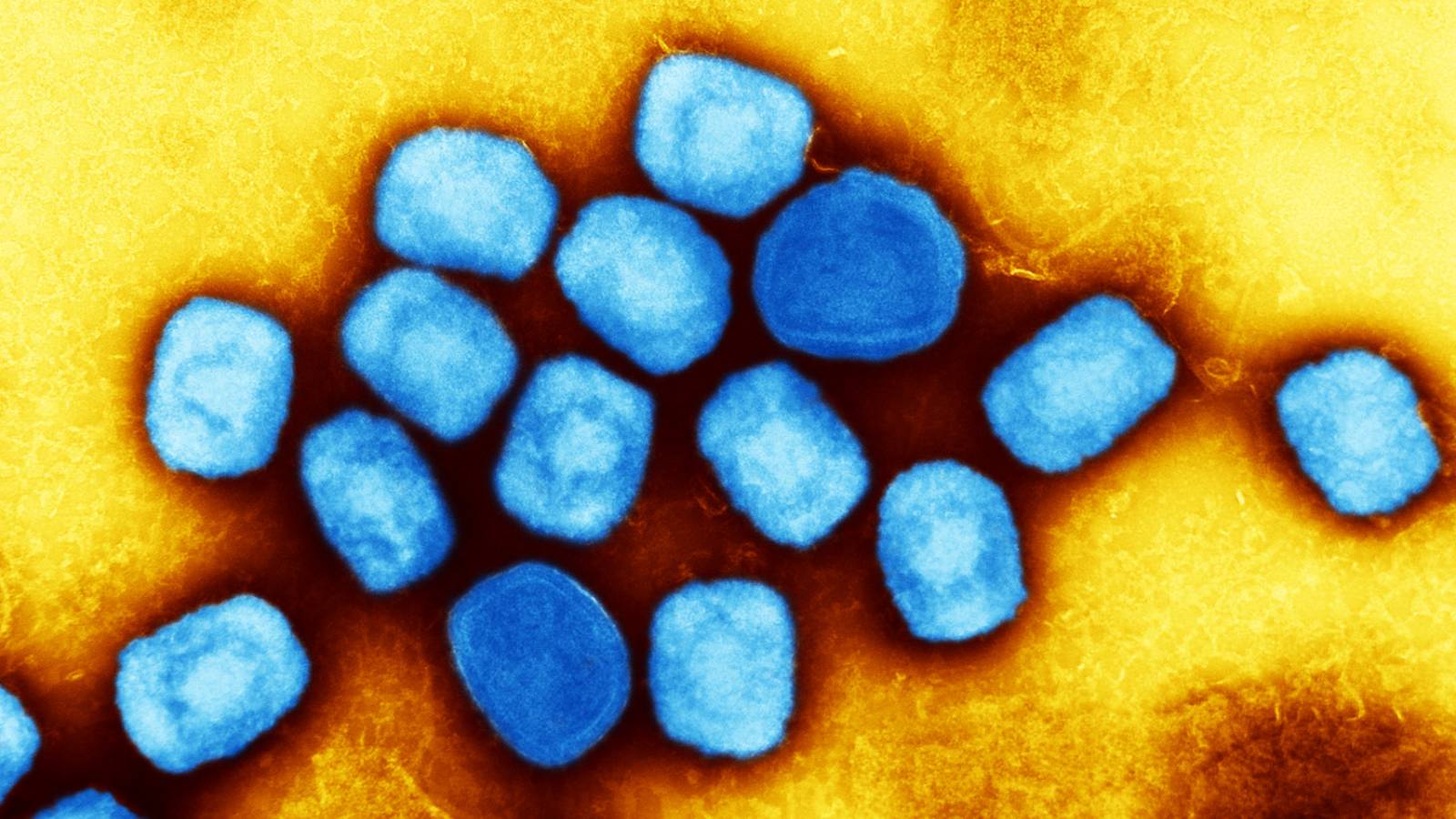 OMS Emite ALERTĂ Globală ULTIM MOMENT Cauza Periculoase Epidemii Derulare